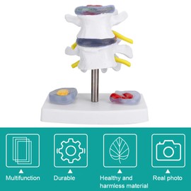 Tyenaza Human Lumbar Vertebrae Model, Skeleton Model Lumbar Vertebrae Model Lumbar Model Model di Vertebre lombari umane (Herniated Disc Model)