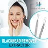 Hula Home Blackhead Remover Pimple Extractor Popper Tool Acne Comedone