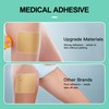Large Silicone Scar Sheets 4 Pcs - 6" x 5"