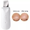 Makegina Limpiador Facial Peeling Ultrasónico Portatil Skin Scrubber