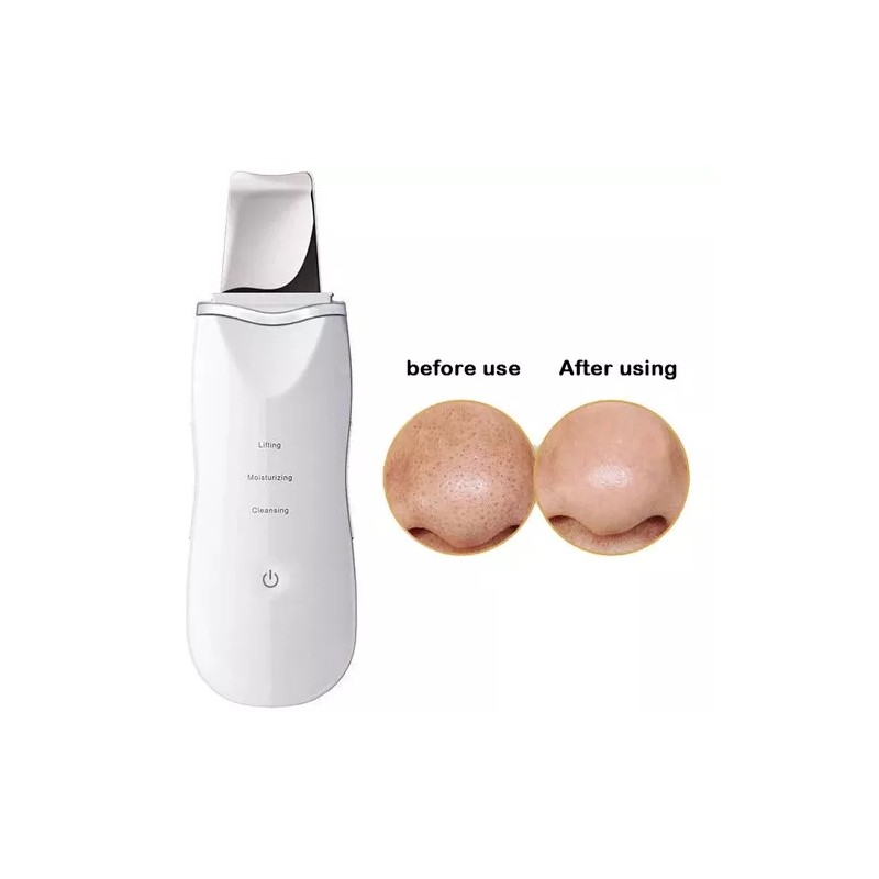 Makegina Limpiador Facial Peeling Ultrasónico Portatil Skin Scrubber