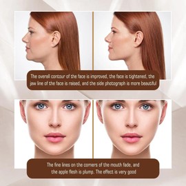 10PCS Chin Lift Mask - Face & V Line Lifting Tape with Collagen for Skin Tightening, Chin Lift Strap for Natural Face Lift