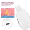 Household Ultrasonic Skin Scrubber EMS MicroCurrent Blackhead Removal Face Pore