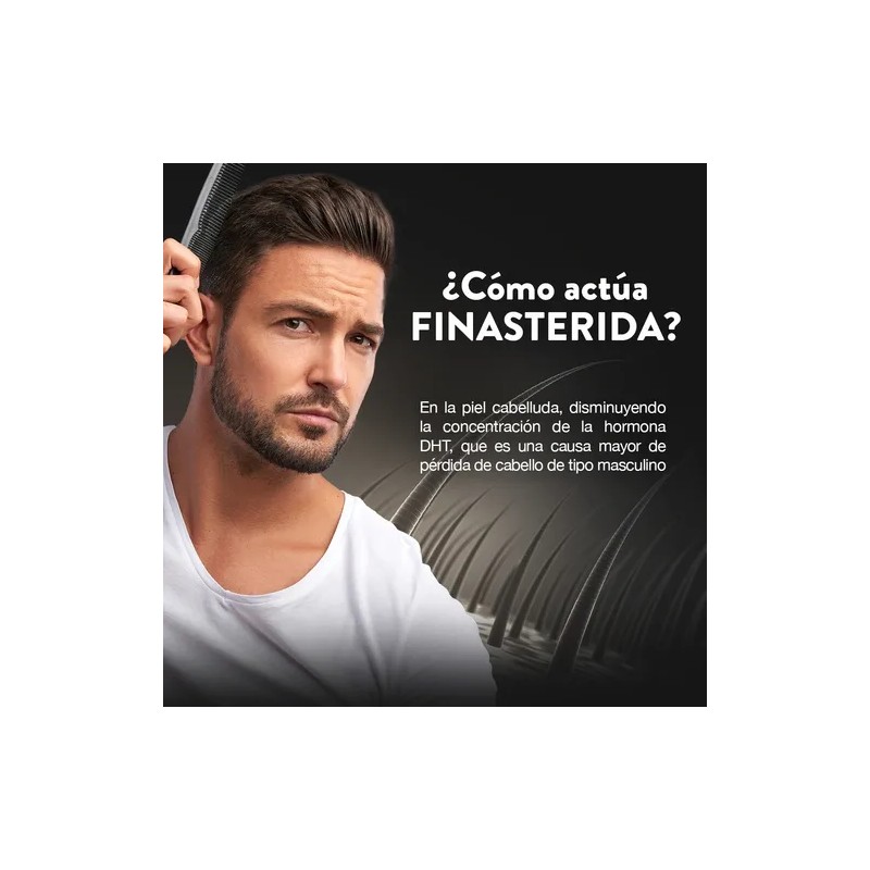 Finasterida 1mg 30 Tabs Shampoo Anticaída Romerox