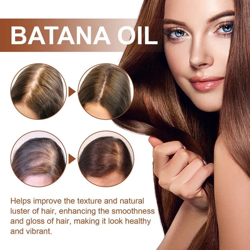 Y Aceite De Crecimiento Del Cabello De Aceite De Batana