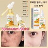 Brightening/Essence/30mL/Whitening/Vita/Serum/Melasma/Whitening/Essence/Ampoule/Spots/Removal/Whiten
