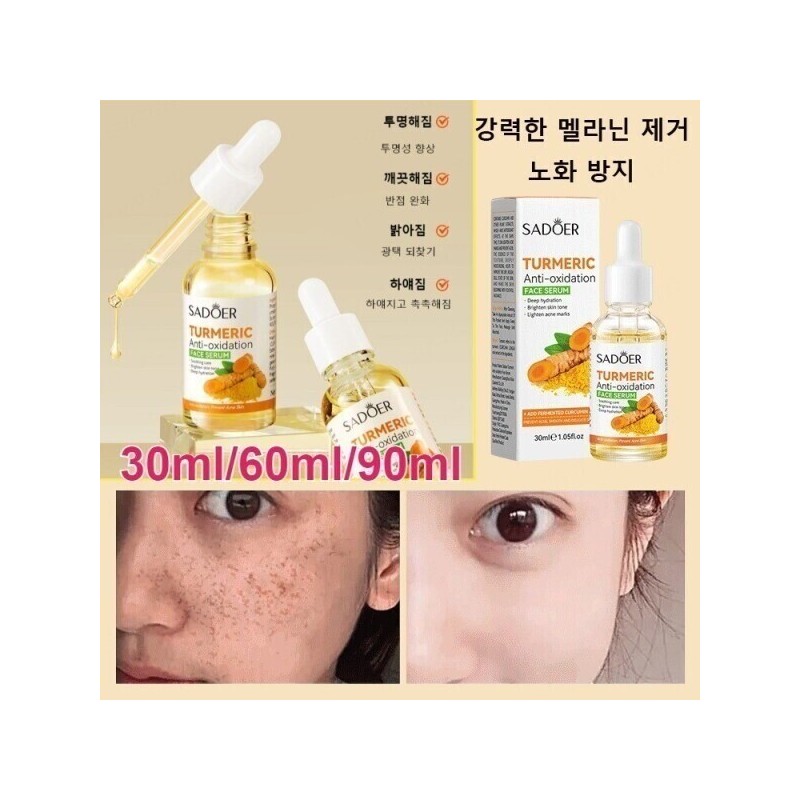 Brightening/Essence/30mL/Whitening/Vita/Serum/Melasma/Whitening/Essence/Ampoule/Spots/Removal/Whiten