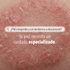 Derman PS Calm Crema Corporal Urea-D 10 Ácido Salicílico 300