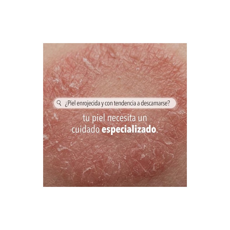 Derman PS Calm Crema Corporal Urea-D 10 Ácido Salicílico 300