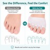 Five-Toe Gel Separator with Forefoot Cushion – Washable Foot Comfort