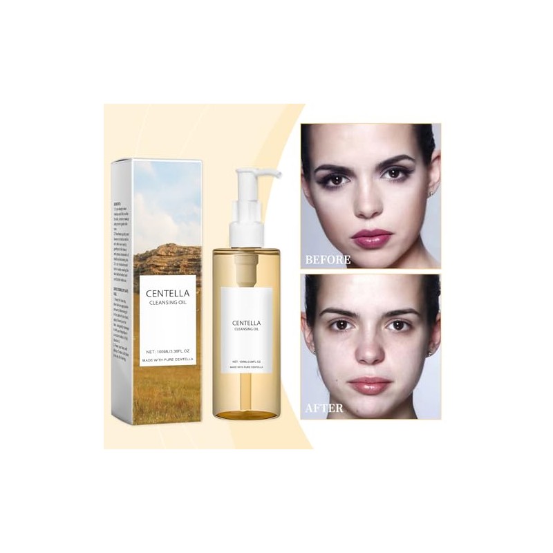 Ymiko Centellas Aceite Limpiador, Desmaquillante con Vitamina E, Enjuagues de