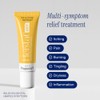 Herstat Gst Tratamiento Dolor Genital Alivio Rápido Efectivo Síntomas Herpes
