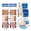 Lmuwecno Varicose Veins Cream(1PCS)