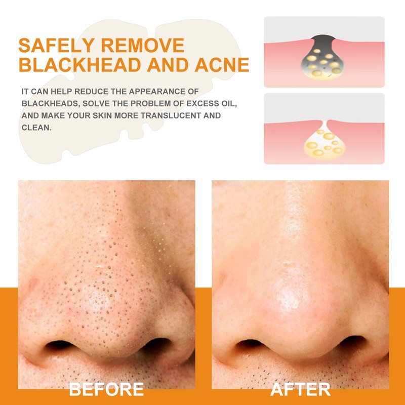 Grospe Blackhead Removal Nose Patch,Deep Cleansing Pore Strips,Instant Pore Unclogging,Deep