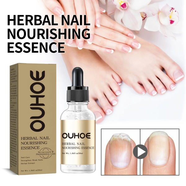 Unbranded Herbal Nail Nourishing Essence, Hand And Foot Moisturizing Care