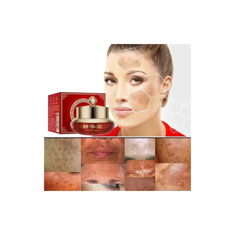 Crema Sangre De Dragón Elimina Paño Manchas Melasma Aclara