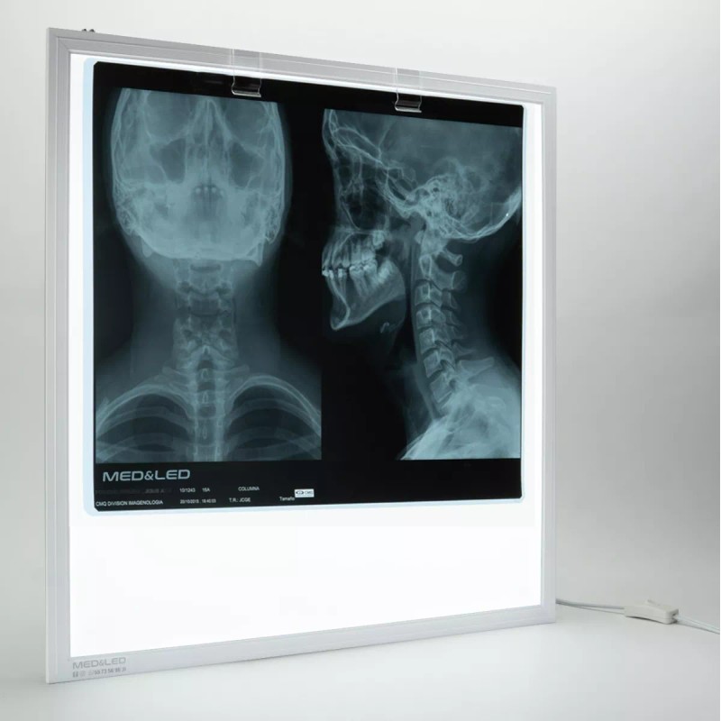 MED&LED Negatoscopio Led Profesional 5500 Lumen Nueva Generación