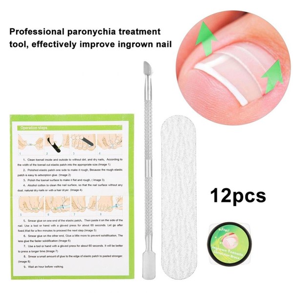 Semme Professional Nail Correction Stickers, Pedicure Paronychia Restore Ingrown Toe Nail Manicure Clipper Fixer Special Pedicure Tools Foot Care Tool Kit (12 Pieces)