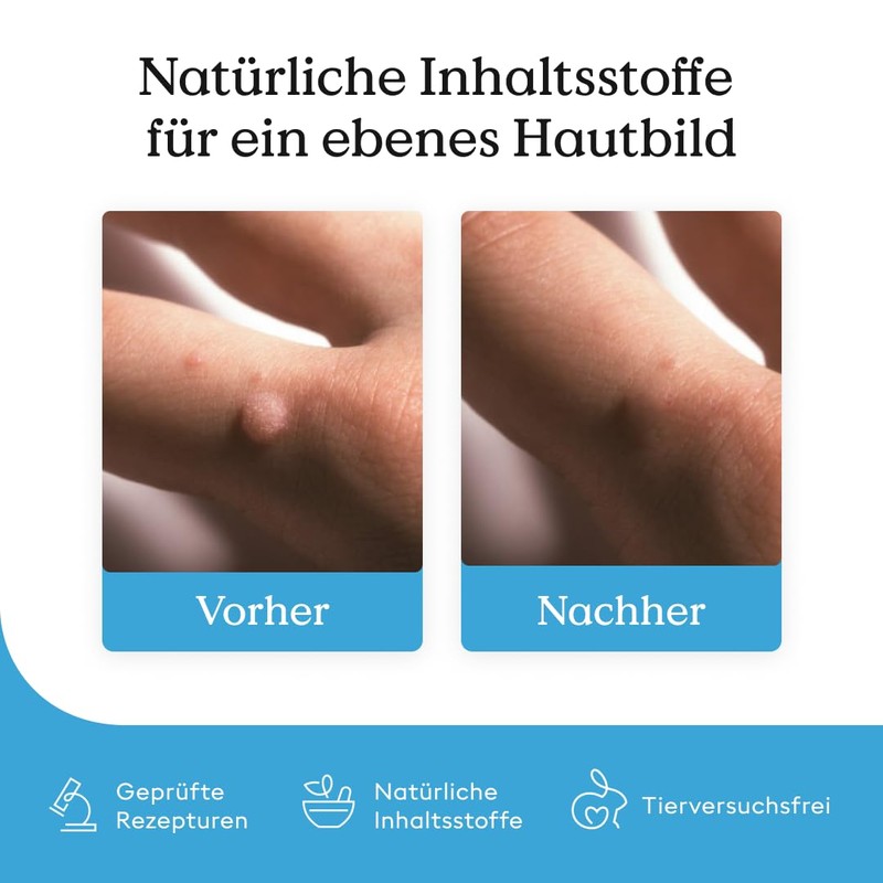 Health Routine Wart Care Pen 3er Pack — Warzenpflege Stift
