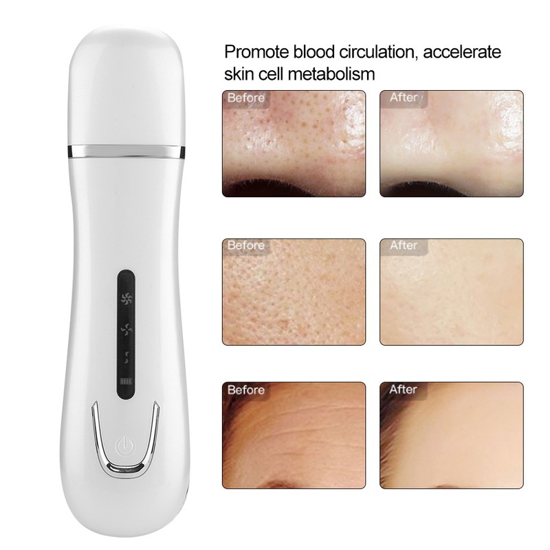 Ultrasonic Face Skin Scrubber Blackhead Removal Ion Cleaner Facial Cleanser