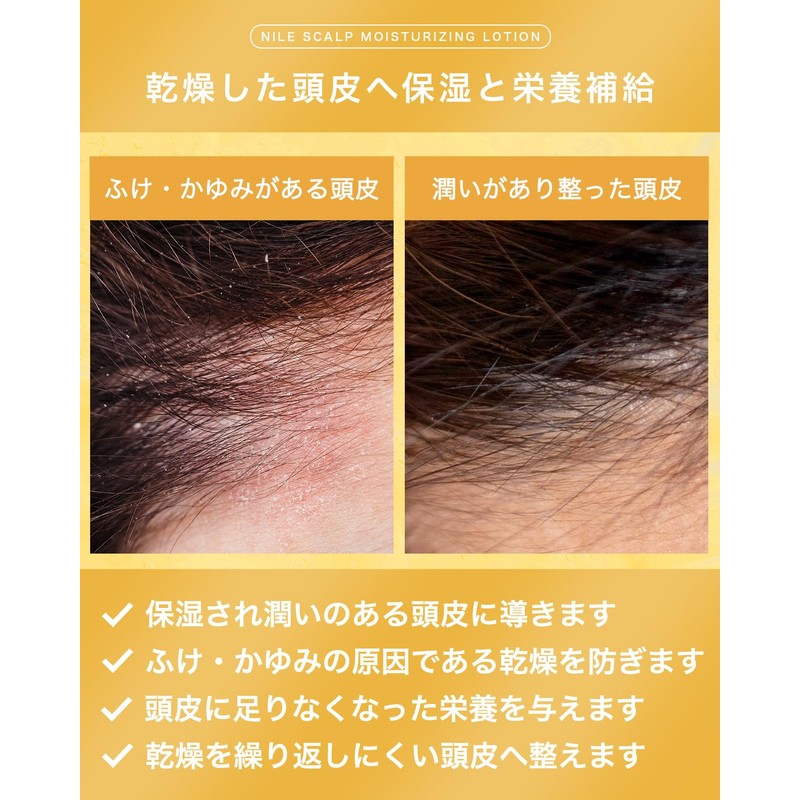 NILE Scalp Moisturizing Lotion, Dandruff and Itch Dry