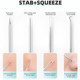 Kit de herramientas de eliminación de puntos negros de grado médico, herramienta de extracción de puntos negros, pinzas de puntos negros, kit de eliminación de etiquetas de piel para eliminar manchas