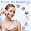 Skin Scrubber Ultrasound, Yeerain Pore Cleanser Face with 4 Modes