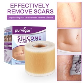 Silicone Scar Tape Roll, 1.6” x 60” Medical Tape for Wound Care Bandages Scars Strips for Surgical Scars Keloid, C-Section, Burns, Injuries Acne, Stretch Marks Removal Sheet Tapes (1.6” x 60”)