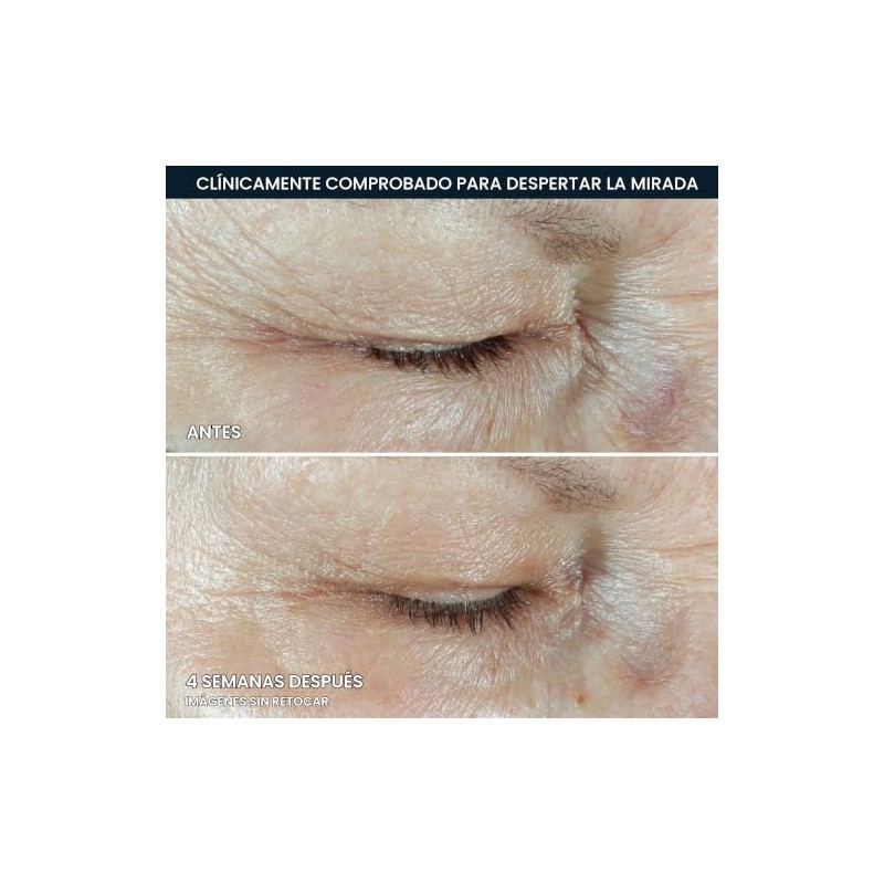 RoC Multi Correxion Crema antienvejecimiento para debajo de los ojos
