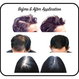 THICKIFY Hair Fibres for Thinning Hair Undetectable & Natural - 28g Bottle - Completely Conceals Hair Loss Instantly - Hair Thickener & Topper for Fine Hair for Women & Men (Black)