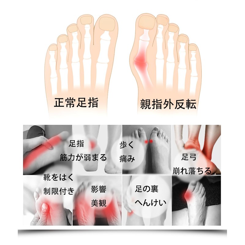 LeTradeJP 足指サポーター 足指広げる パカッと広げる水洗い可能 簡単着脱 左右兼用 (1はい)