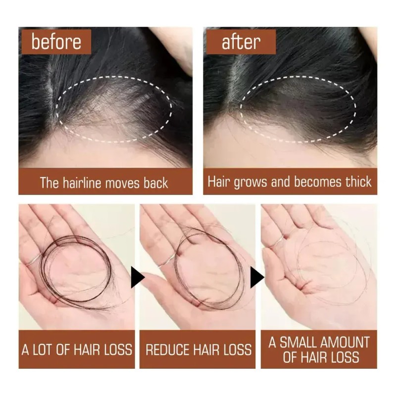 Aceite De Batana Para El Crecimiento Del Cabello, Cabello As