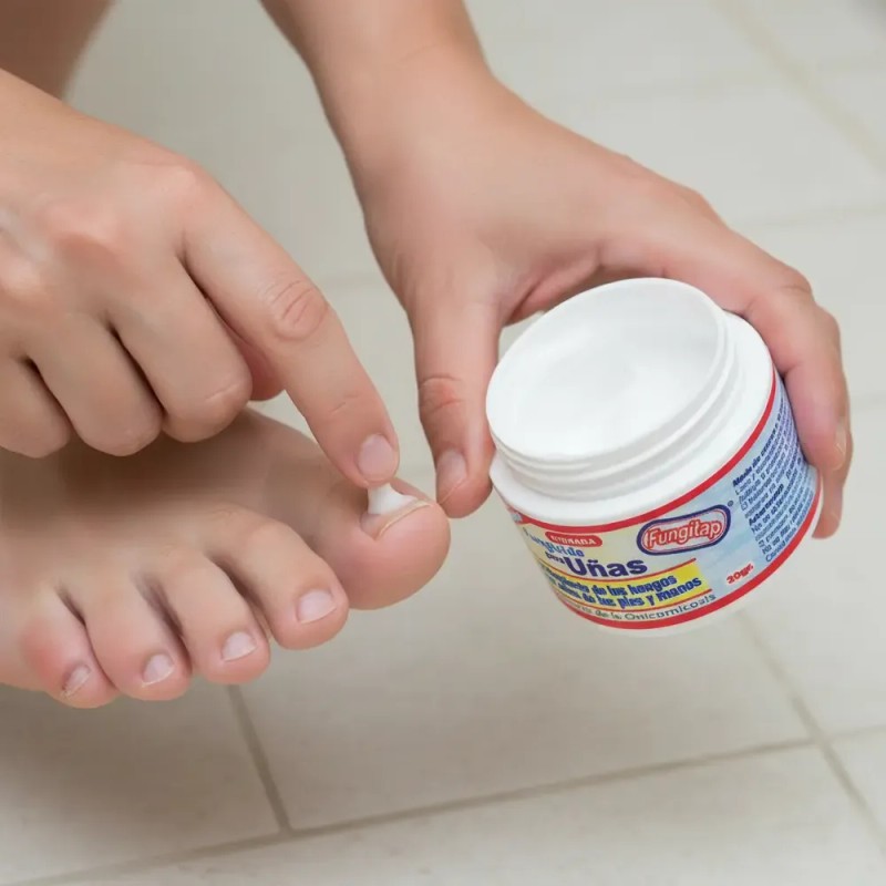 Pomada Fungicida Para Uñas Con Hongos Onicomicosis Fungitap