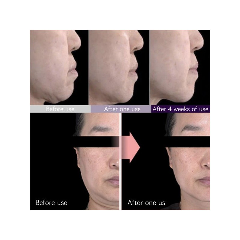 MEDITHERAPY Inmotox Tension Up Mask 28g*5ea