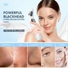 Blackhead Remover Pore Vacuum, Upgraded Black Head Remover for Face,