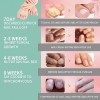2 Lápices Tratamiento Antihongos Para Uñas