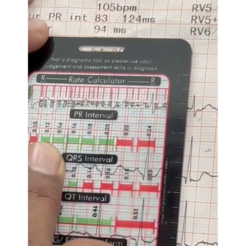 Febz EKG/ECG Ruler for Measuring intervals
