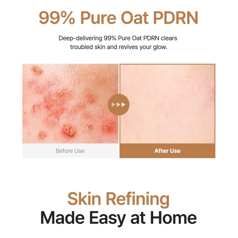 Purito Seoul Oat Pdrn Gentle Refining Toner 200ml Todo Tipo