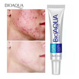 Crema Anti Acné Control Grasa Puntos Espinillas Poros Barros