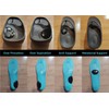 Adhesive Gel Ramp for Overpronation, Supination, Arch Support or Metatarsals