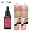 Rosehip Oil for Face, Certified Organic Rosehip Oil, use of