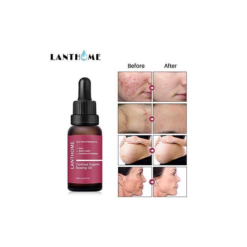 Rosehip Oil for Face, Certified Organic Rosehip Oil, use of