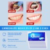 chimoo Whitening Strips, 28 Strips Teeth Whitening Peroxide Free Teeth