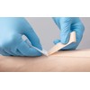 Smooth Remover 19813 Wipe Sheet 50 Iri Stoma Care Products