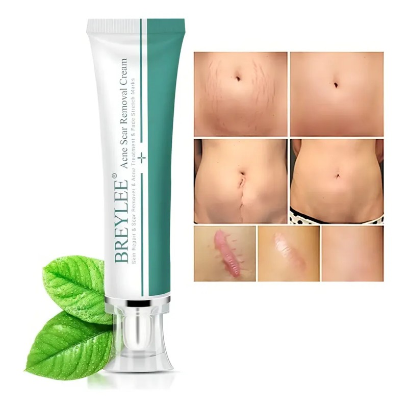 Breylee | Crema Elimina Estrías, Cicatrices, Acné Y Manchas