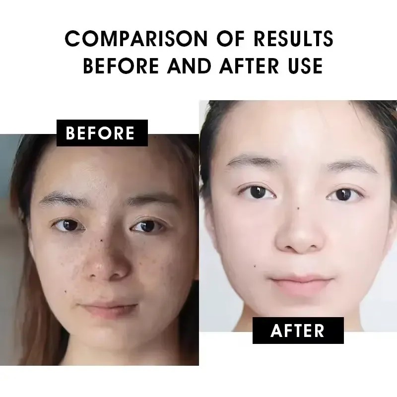 Vitamin C Brightening Serum, Hydrates & Evens Skin