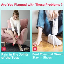 Byehambuni Pinky Hammer Toe Straightener - Hammer Toe Corrector - Hole Diameter 0.5 inches - Elevates Toe-Tip, Soothes Corn - Toe Straighteners for Curled Toes - Beige, 6pcs Small Size