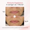 MASDERM Ultrasonic Face Cream High Frequency Moisturising Face Cream Anti-Wrinkle