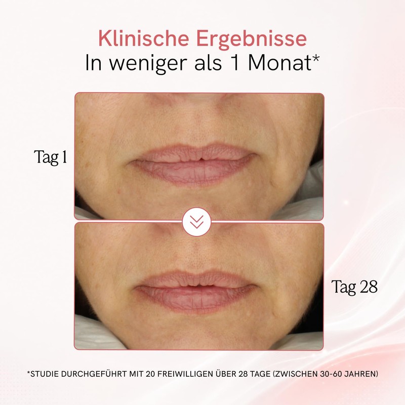 MASDERM Ultrasonic Face Cream High Frequency Moisturising Face Cream Anti-Wrinkle