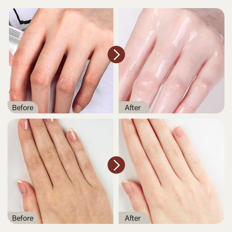 ARCHIDATE Retinol Hand Cream for Aging Hands, Hydrating Hand Cream